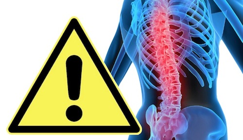 Rischio da sovraccarico Biomeccanico: Monografie INAIL